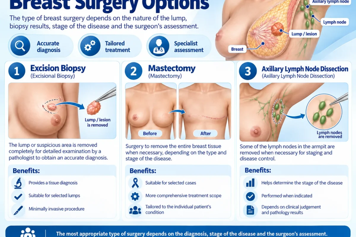 Infographic of breast surgery options, including wide local excision and mastectomy.