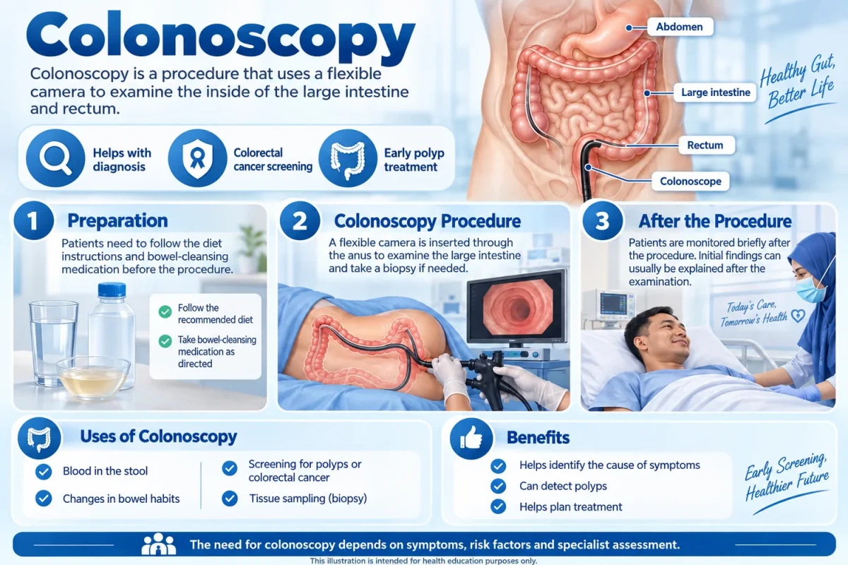 Infographic of colonoscopy, showing a flexible camera examining the large bowel.