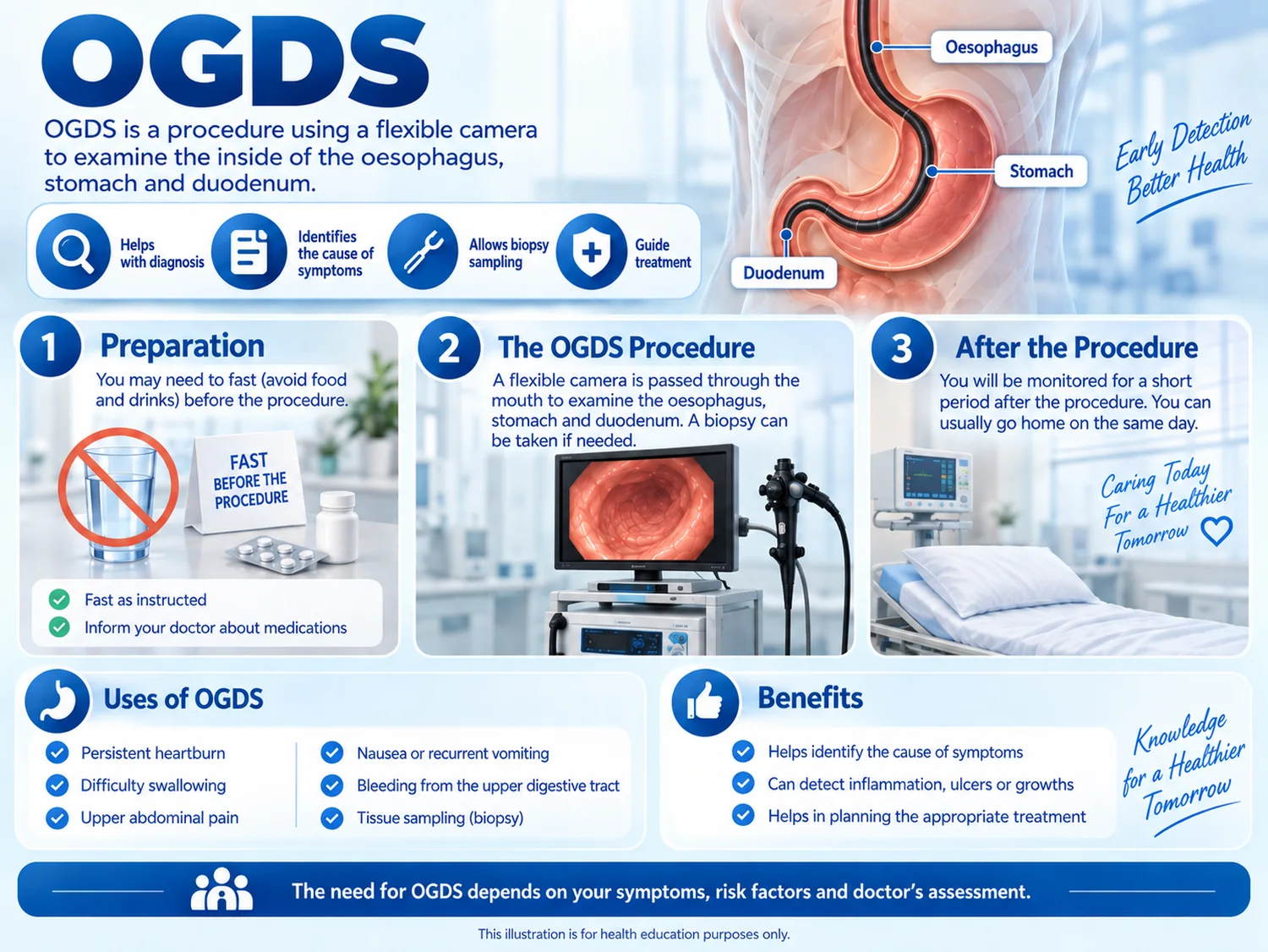 Infographic of OGDS or gastroscopy, showing a flexible camera examining the stomach.