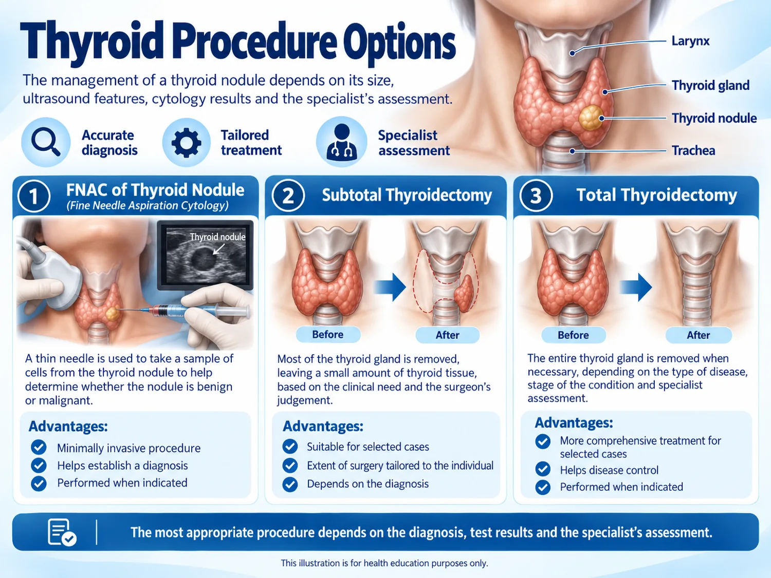 Infographic of thyroid procedure options, showing FNAC of a thyroid nodule and partial and total thyroidectomy.